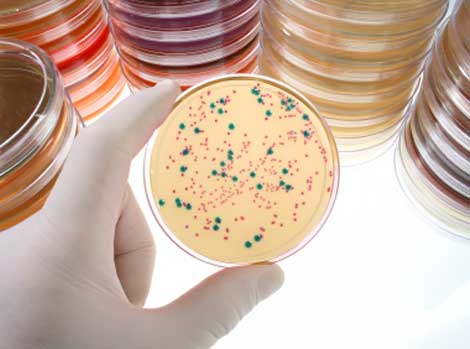 Blue/White colony screening helps you pick only the colonies that have your insert.