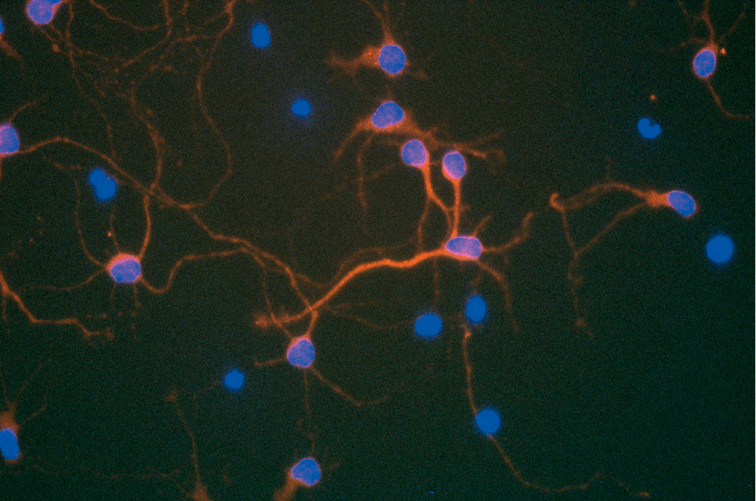 Anti-Rat CNTF polyclonal antibody.