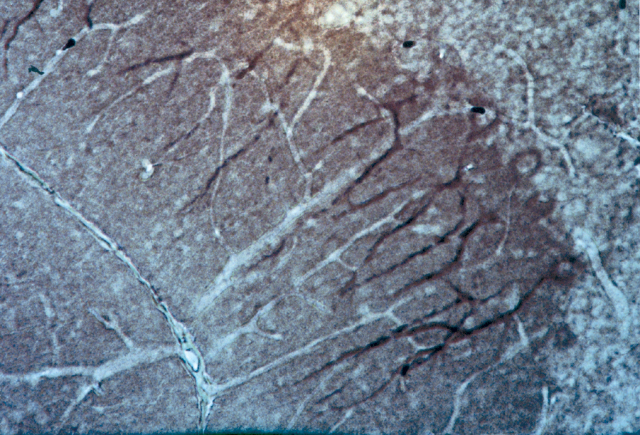 Anti-TrkB In polyclonal antibody.