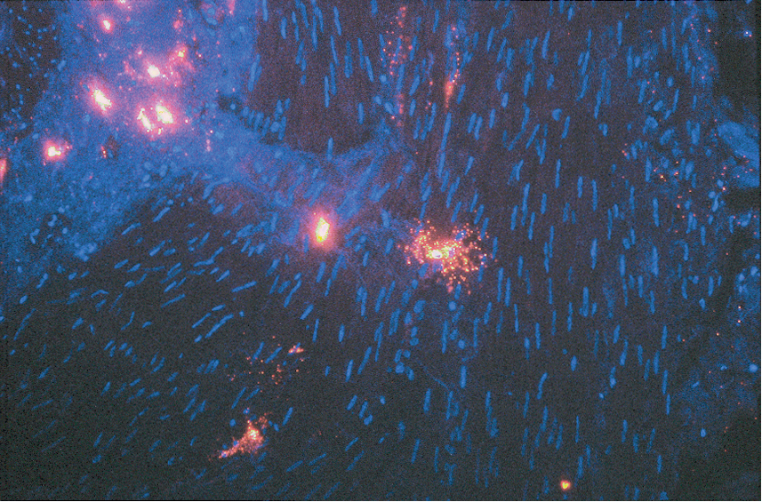 Anti-human tryptase monoclonal antibody.