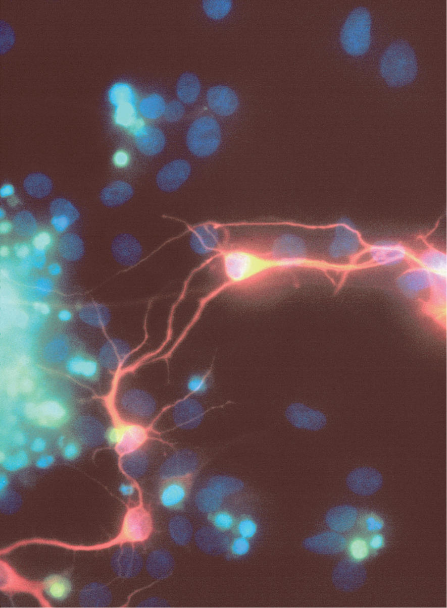 Anti-beta III tubulin stain, and Fluorescent TUNEL Assay.