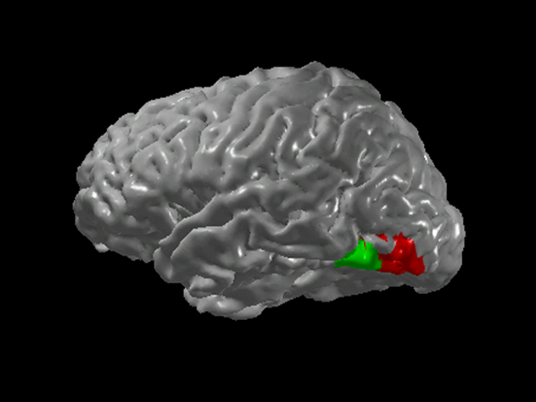 Brain image showing the proximity of word forming and colour regions. Image originally provided by E.M. Hubbard, used with his permission and that of Wikipedia.