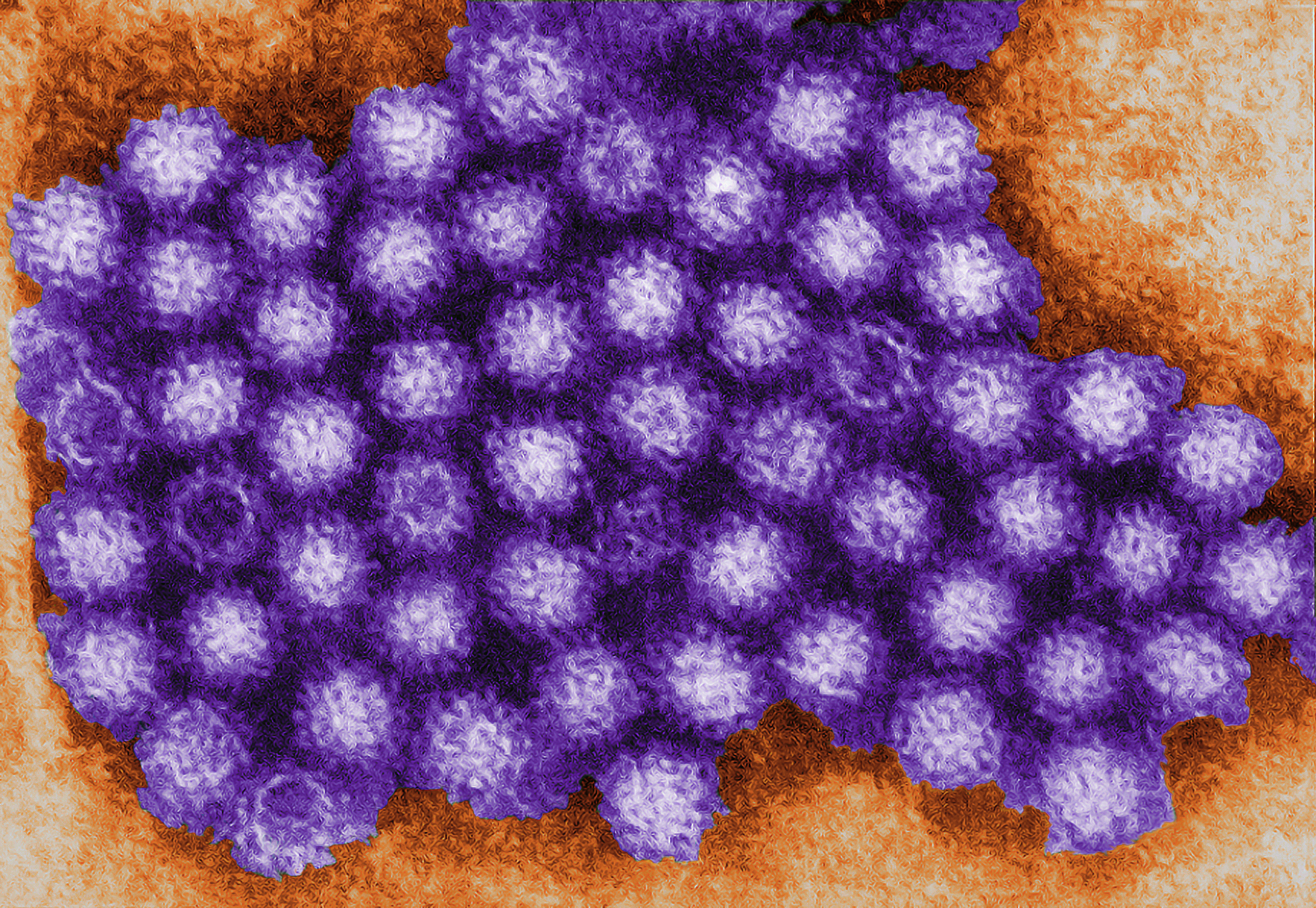 TEM of Norovirus particles. Photo Credit: Charles D. Humphrey, Centers for Disease Control and Prevention