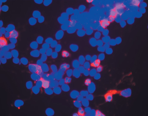 Anti-Active® Caspase-3 pAb labeling of apoptotic human neuroblastoma cells treated with staurosporine.