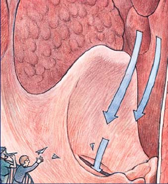 Illustration from David Macaluay's "The Way We Work", showing visitors throwing paper airplanes down air passages through the trachea.