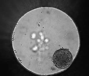 Differential contrast image of HCT116 colon cancer spheroid grown in a 96-well hanging-drop platform after seeding with 800 cells. Copyright Promega Corporation.