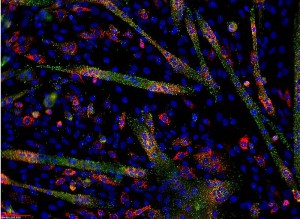 miR-133 microRNA (green) and myogenin mRNA (red) in differentiating C2C12 cells. Image by Ryan Jeffs, courtesy of Wikimedia Commons.