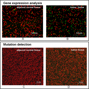 Figure 5 shows typical scanned images of bead-array for analyzing adjacent normal tissue and tumor tissue. Huang et al. (2015) Digital Detection of Multiple Minority Mutants and Expression Levels of Multiple Colorectal Cancer-Related Genes Using Digital-PCR Coupled with Bead-Array. PLOS ONE 10(4):e0123420. doi:10.1371/journal.pone.0123420.g005 