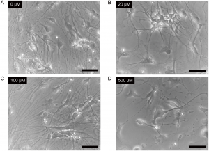 Figure 2. Ketamine induced morphological changes in neurons derived from iPSCs. Cells were treated with 0μM (Panel A), 20μM (Panel B), 100μM (Panel C) or 500μM (Panel D) ketamine for 24 hours. doi:10.1371/journal.pone.0128445.g002