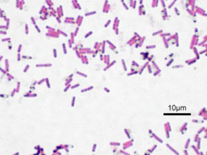 Bacillus subtilis, an example of Firmicutes, and not a good gut microbe. By Y tambe (original uploader) - Own work, CC BY-SA 3.0, https://commons.wikimedia.org/w/index.php?curid=49528