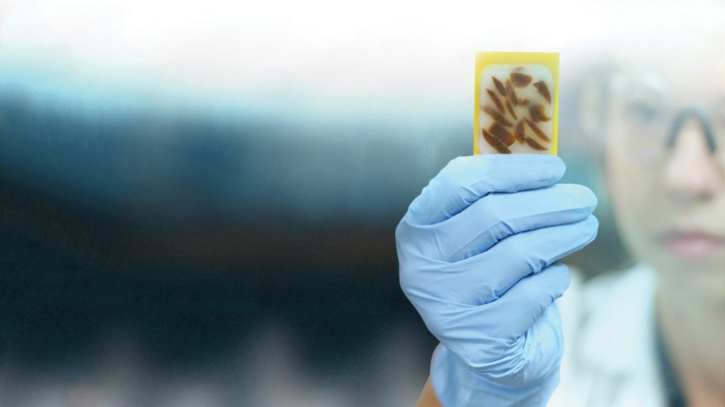 Scientist holding up an FFPE tissue sample. Such samples are vital for nucleic acid extraction required for retroactive studies.