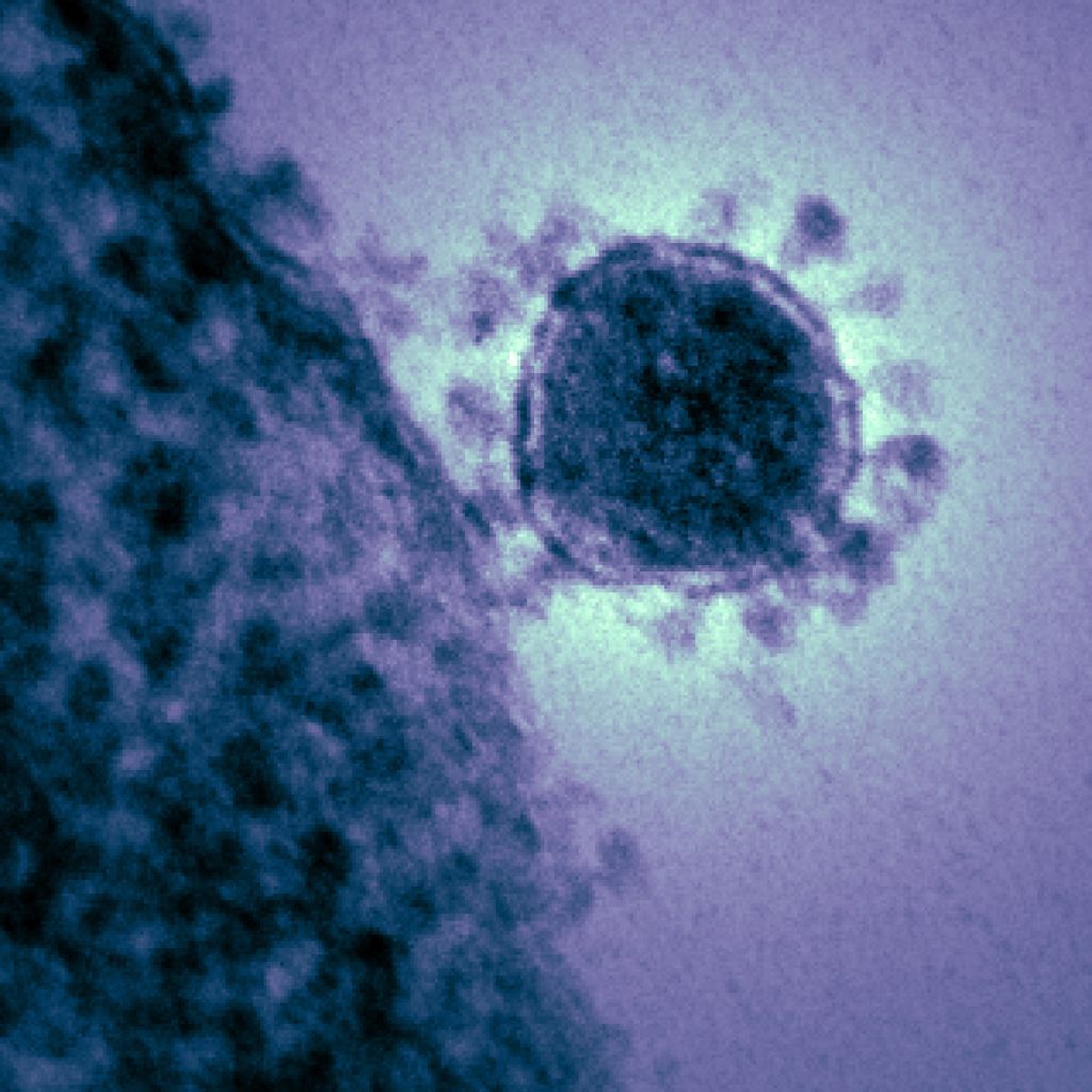 TE micrograph of a single MERS-CoV