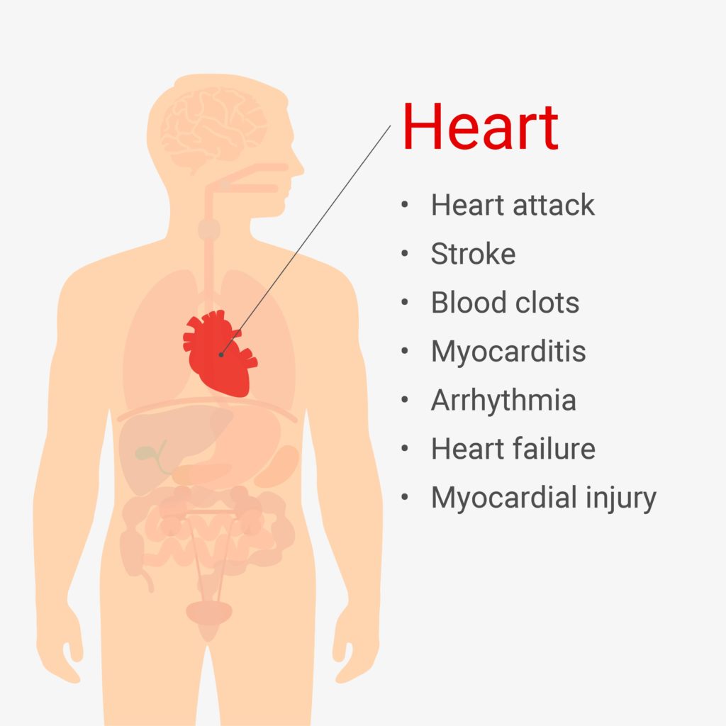 Cardiovascular COVID-19 symptoms