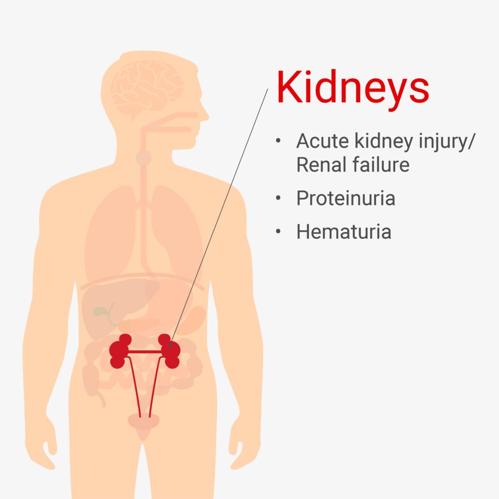 Renal COVID-19 symptoms