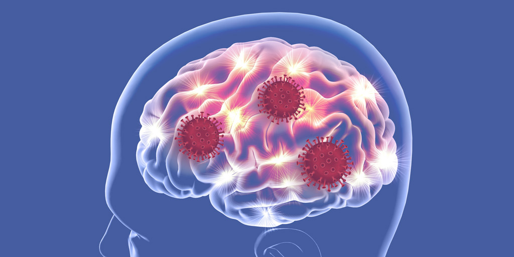 Artist conception of coronavirus in the brain. Researchers are investigating the neurotropic effects of SARS-CoV-2