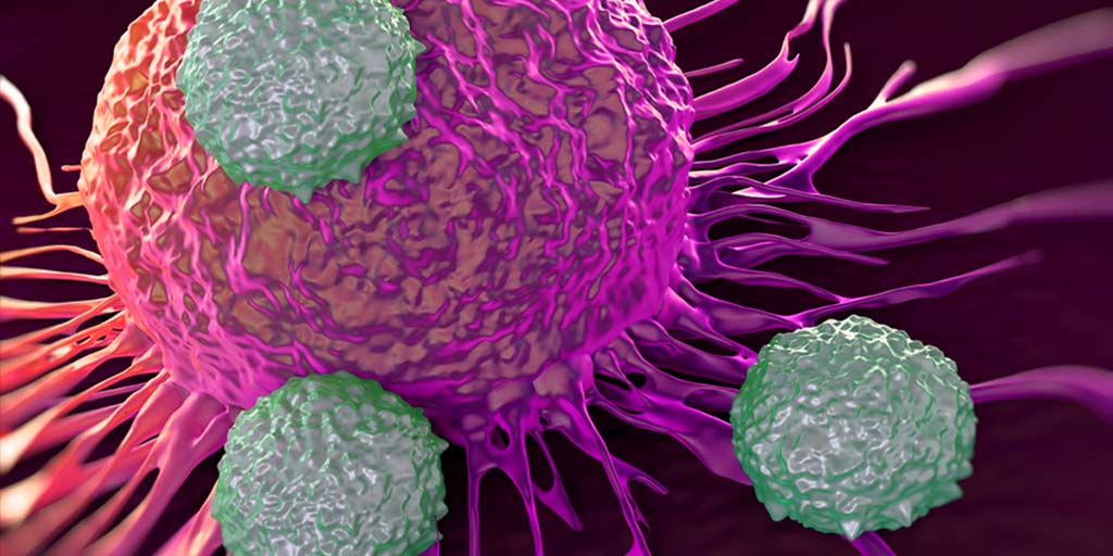 Artist rendition of immune cells attacking a cancer cells. Immune checkpoint inhbitor therapy is a relatively new therapy for certain cancers.