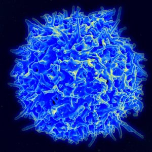Chimeric antigen receptor T cells (CAR T cells)