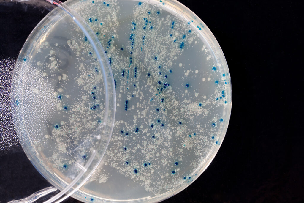 Blue and white colonies on a selective plate. Careful planning can help you avoid the cloning blues